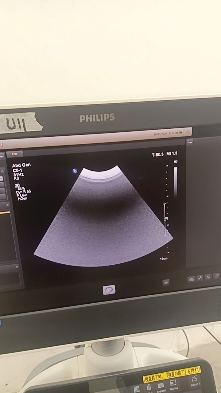 Philips EPIQ 7G ultrasound Refurbished equipment