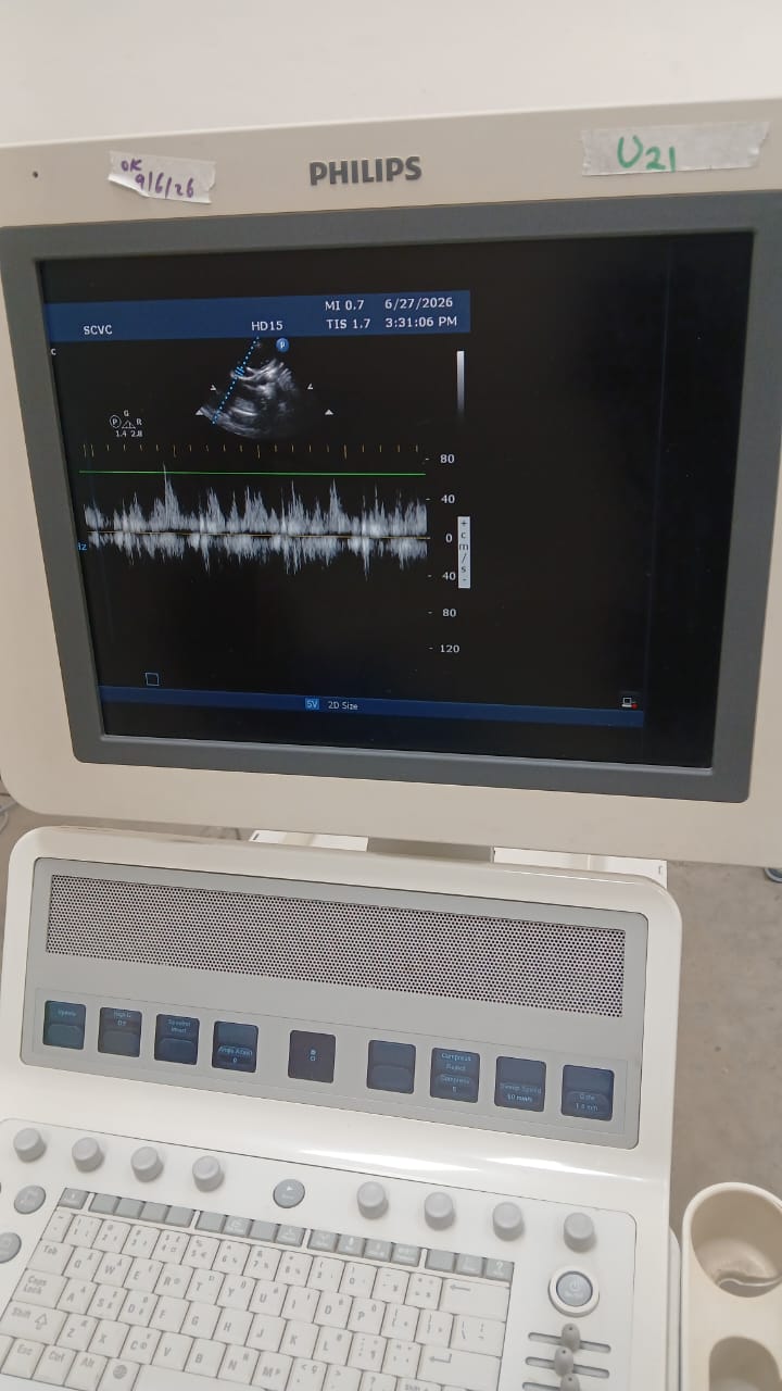 PHILIPS HD15 ULTRASOUND MACHINE with Cardiac Array probe. BH