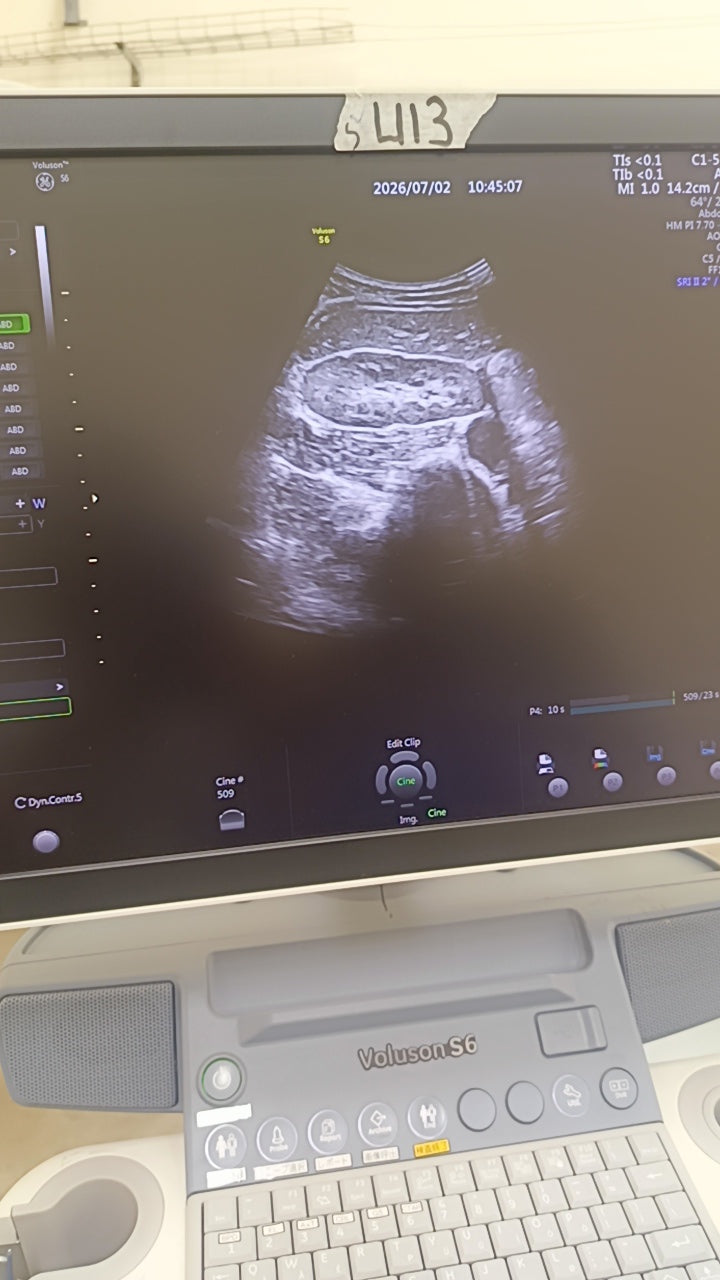 GE Voluson E8 BT16 4D Ultrasound System (2016) with RAB6-D Probe – HDlive – OB/GYN
