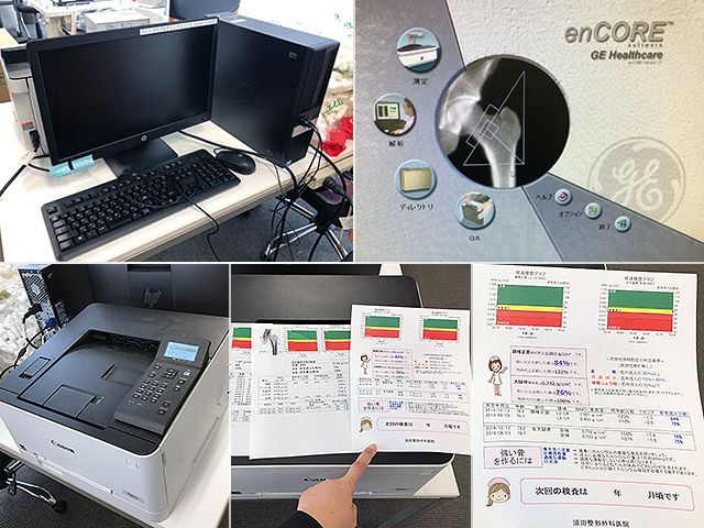 GE Bone Densitometer Chorale β 2018 Model refurbished equipment