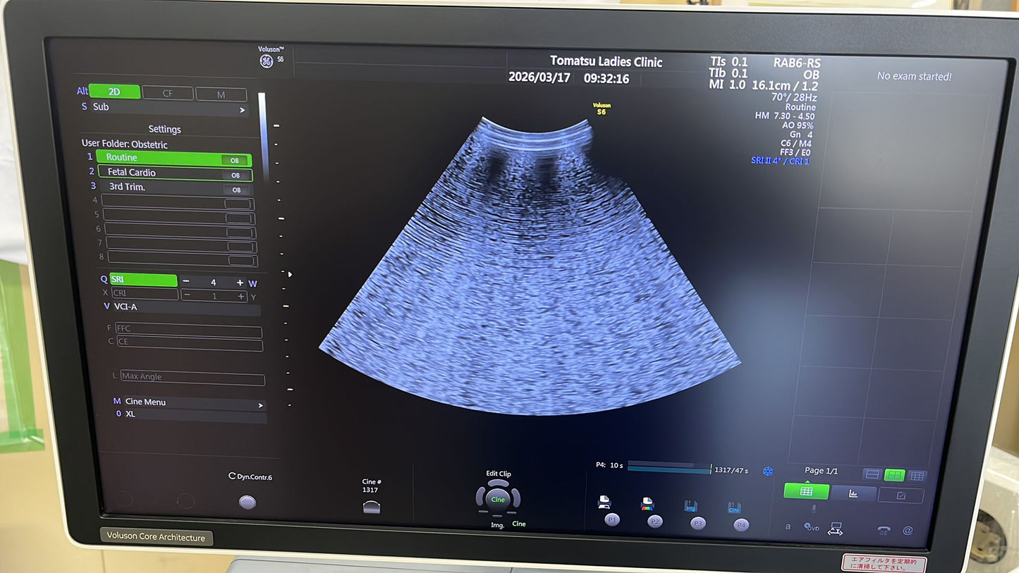 GE Voluson S6 BT16 Ultrasound System, moy:2018 with convex and 4D convex array probe