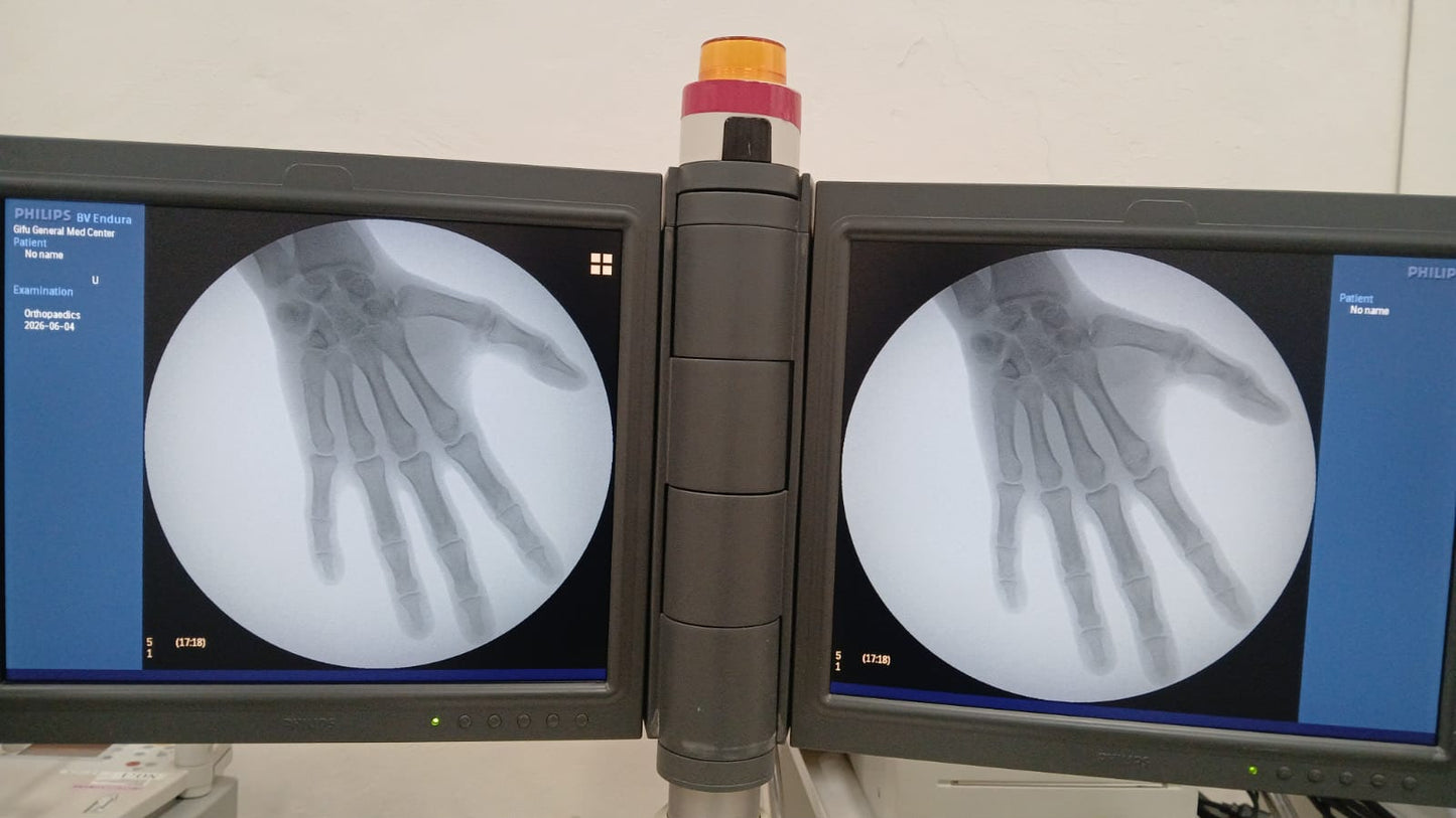 Philips BV Pulsera C Arm refurbished machine