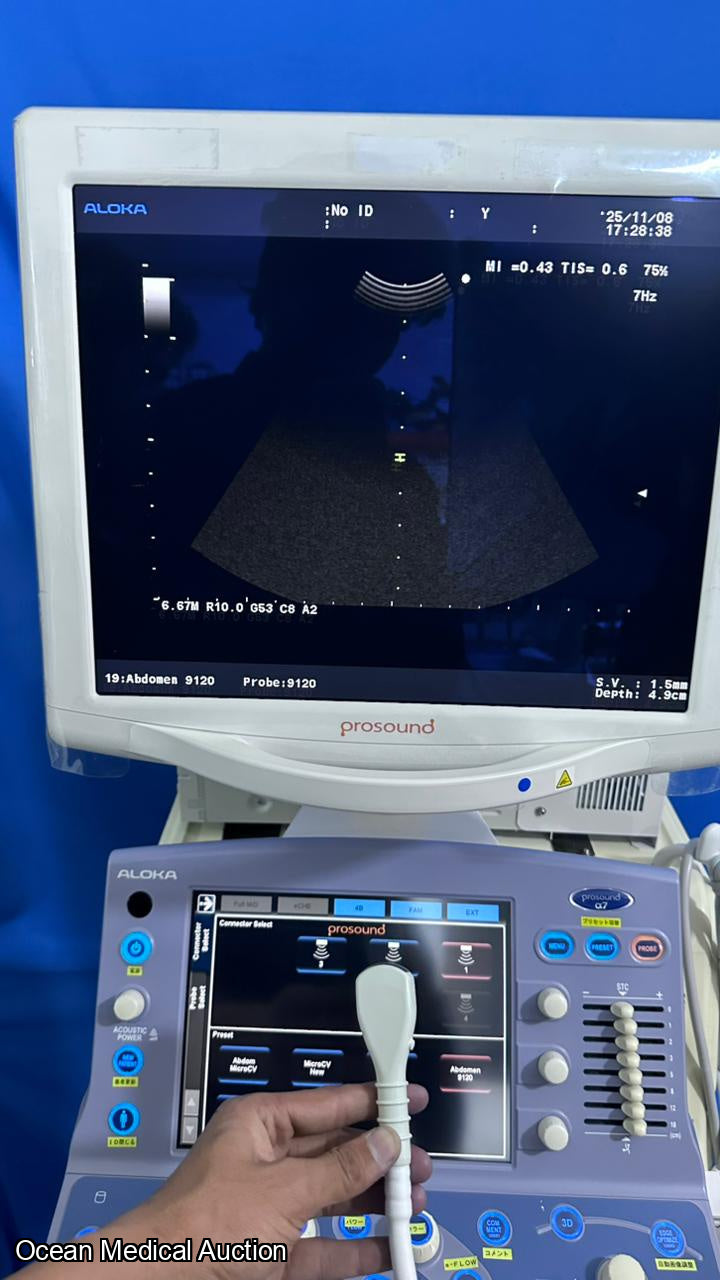 Hitachi Aloka alpha 7 ultrasound with convex,linear and cardiac probe