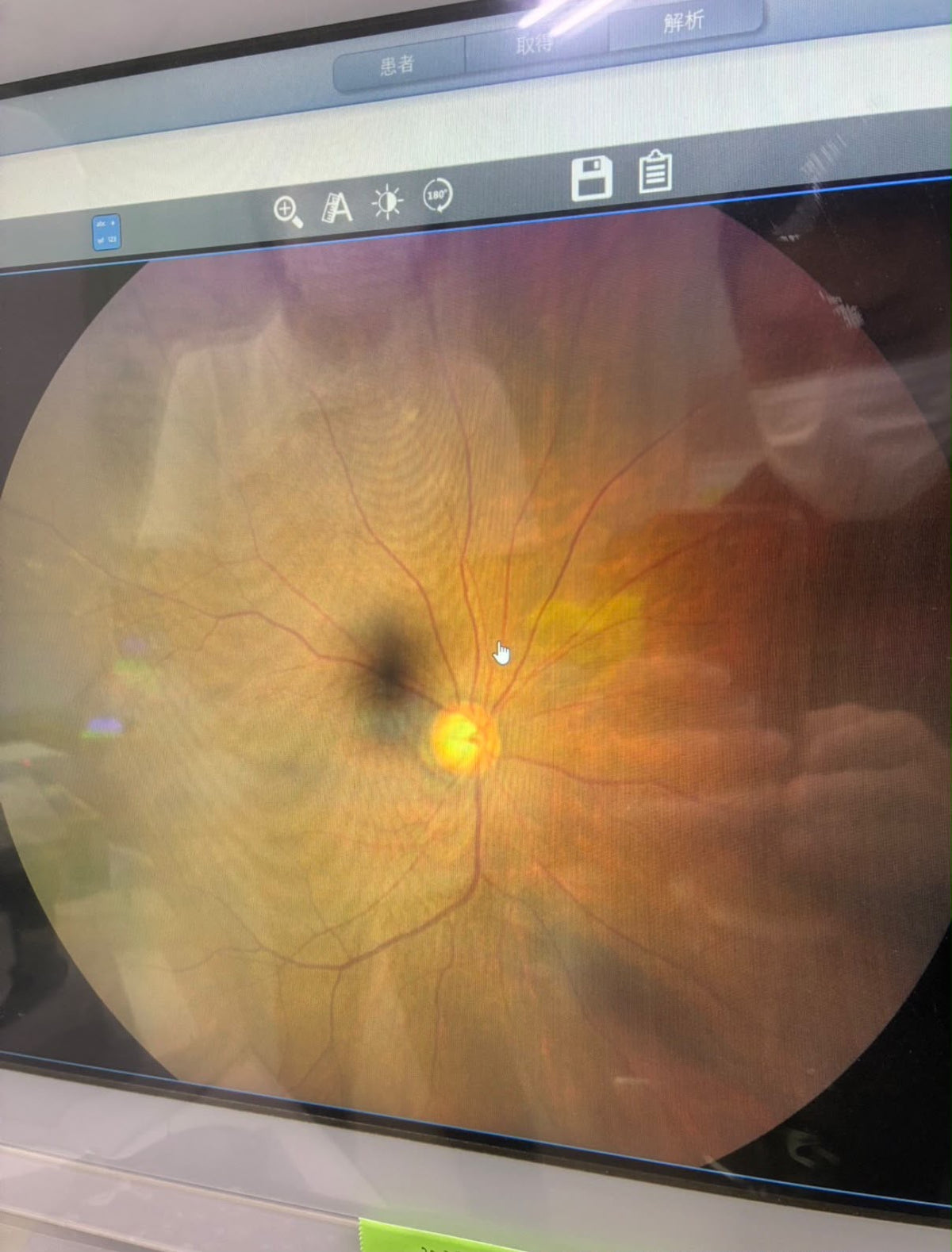 ZEISS CLARUS 500