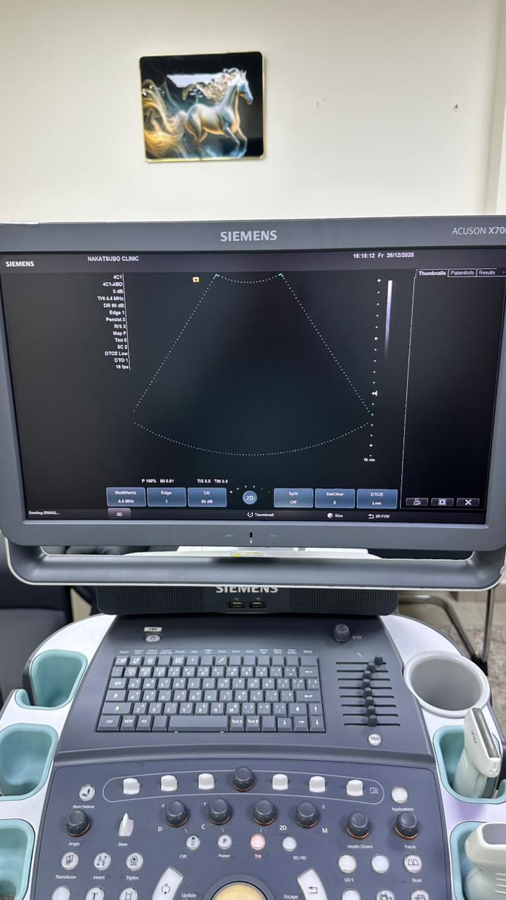SIEMENS ACUSON X700 ULTRASOUND WITH LINEAR AND CONVEX PROBE