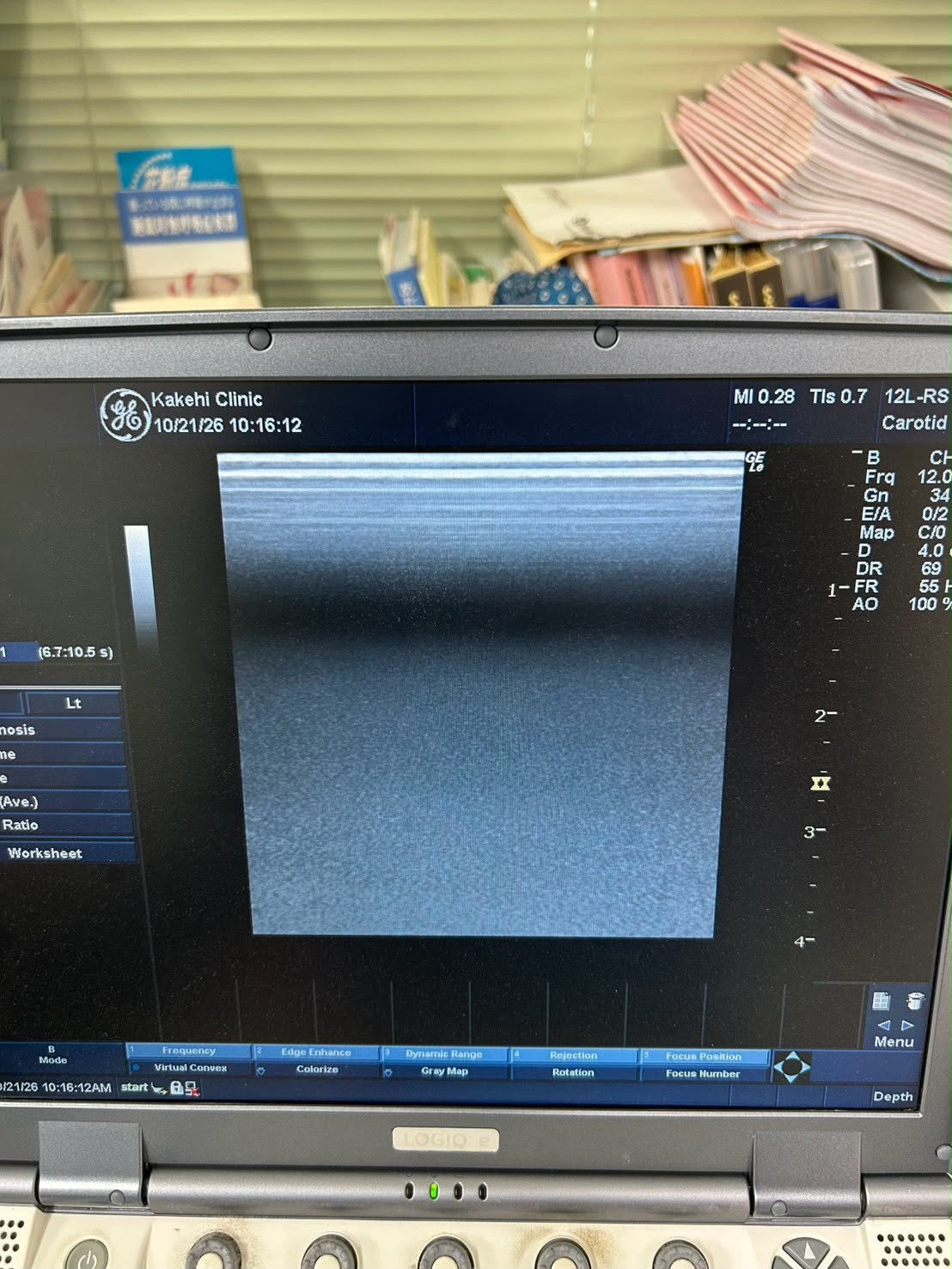 GE LOGIQ e Rev 2 Portable ultrasound