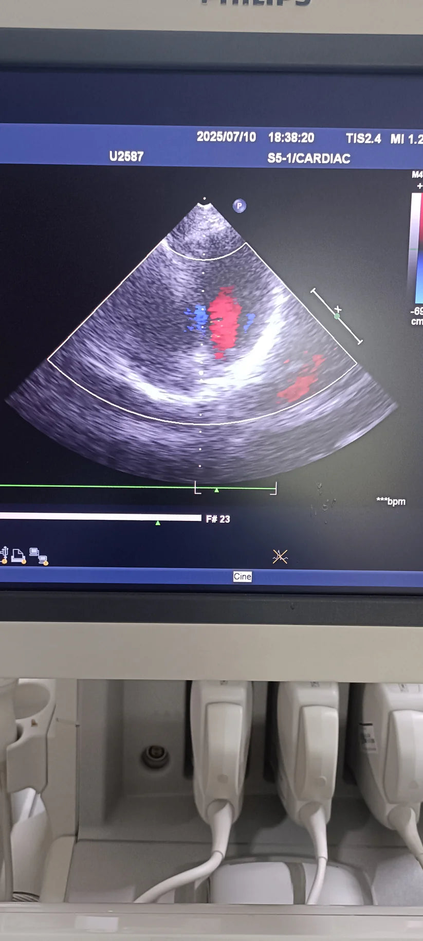 Philips s5-1 cardiac probe sn. 03FG2X checked dxb IS (MW)