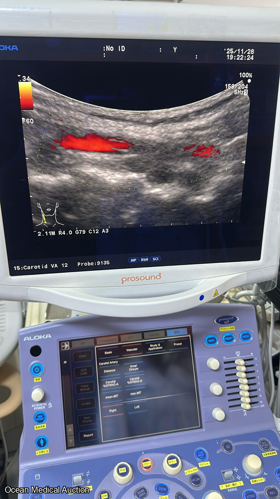 Aloka Ust 9135p curved (convex) array ultrasound transducer / probe.SN.20050045