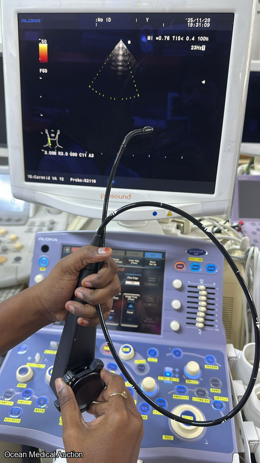 Aloka ust 52110s neonatal / pediatric T.E.E. SN.20004764