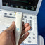 GE Vivid i Portable Ultrasound System (2007) with 3S-RS Cardiac Probe