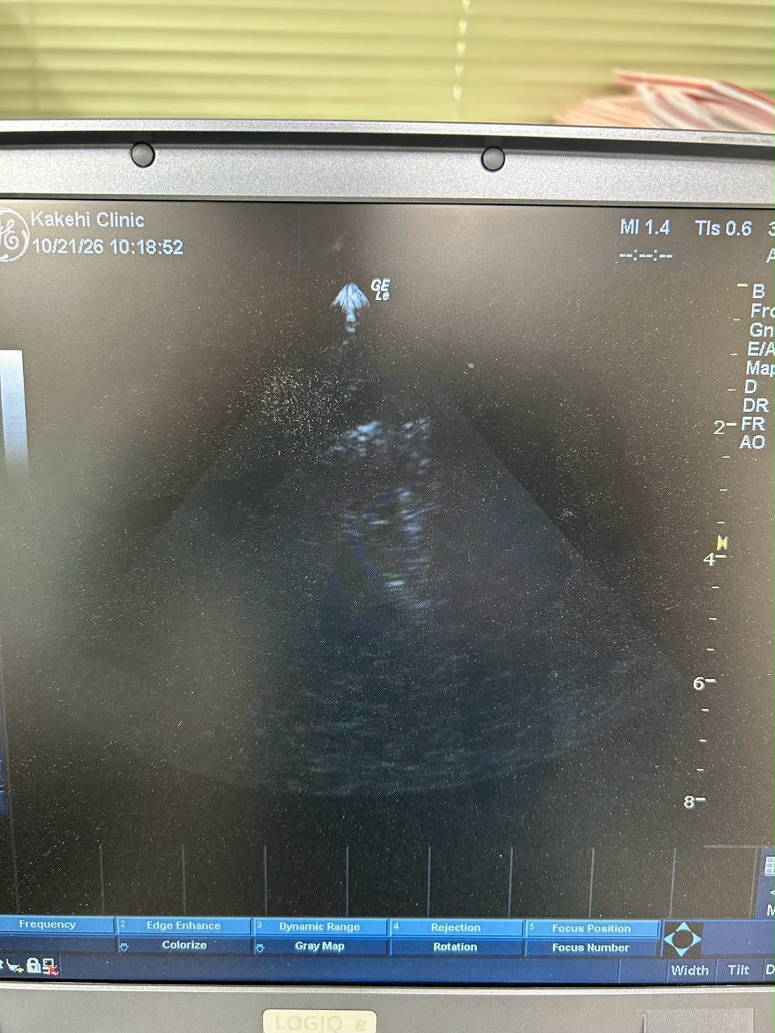 GE LOGIQ e Rev 2 Portable ultrasound