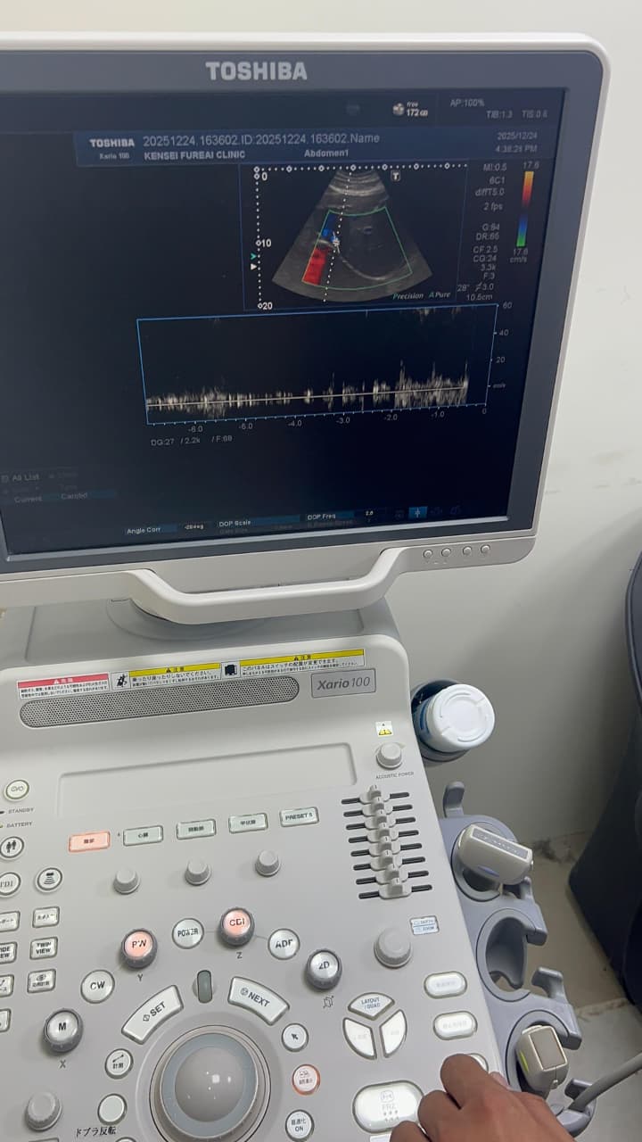 Toshiba Xario 100 ultrasound with cardiac,linear and convex probe refurbished equipment