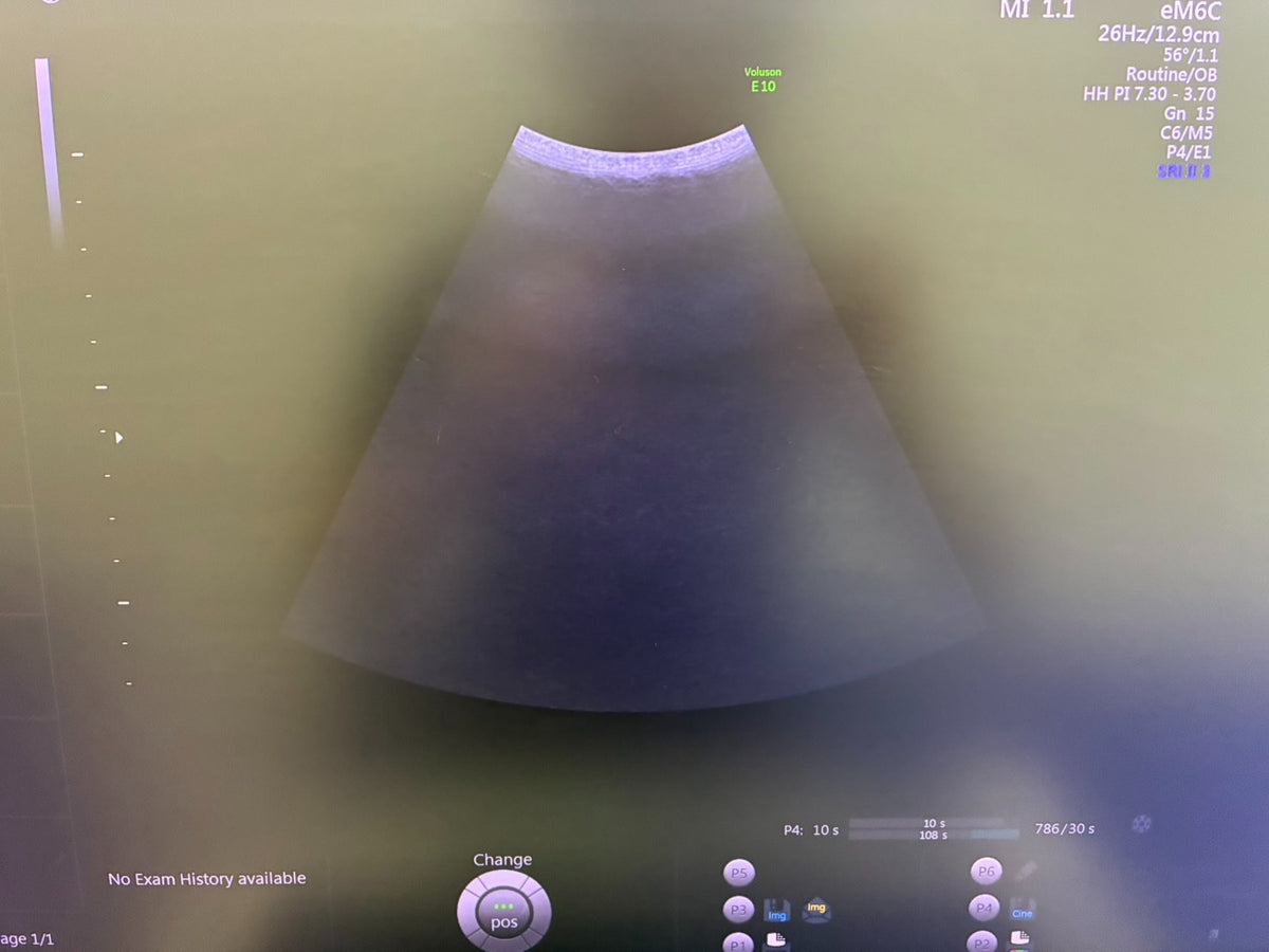 GE VOLUSON E10 Ultrasound