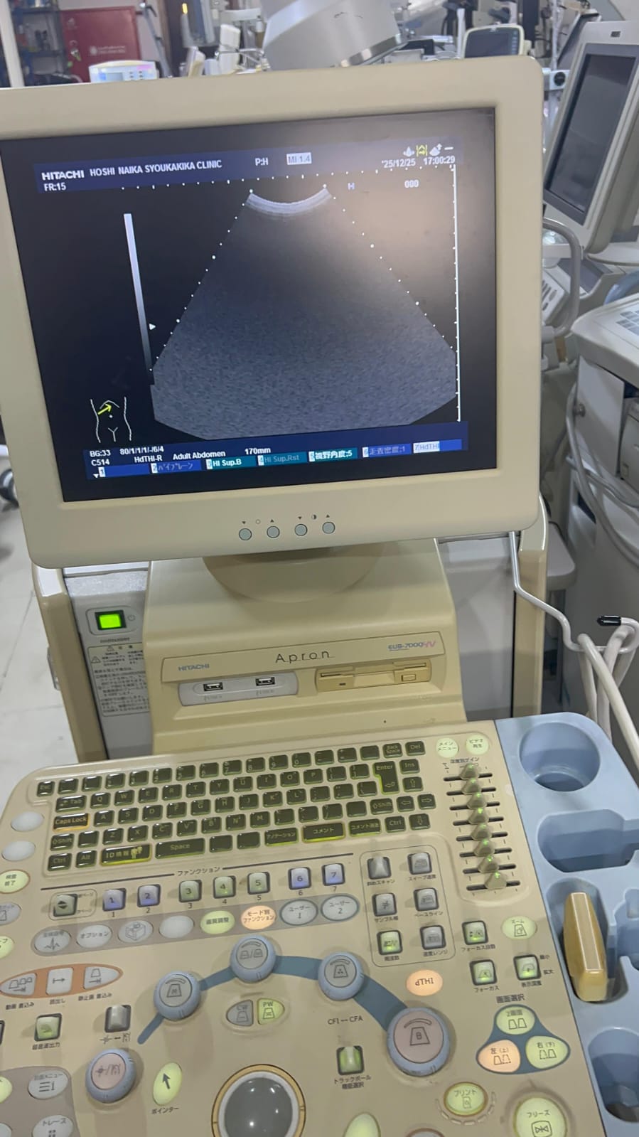 Hitachi apron ultrasound with convex and linear probe