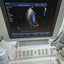 Hd11xe ultrasound With adult cardiac pediatric cardiac  and linear probes