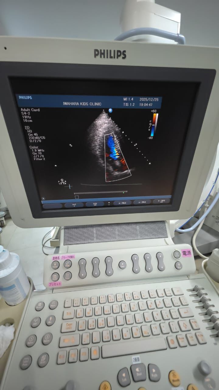 Hd11xe ultrasound With adult cardiac pediatric cardiac  and linear probes