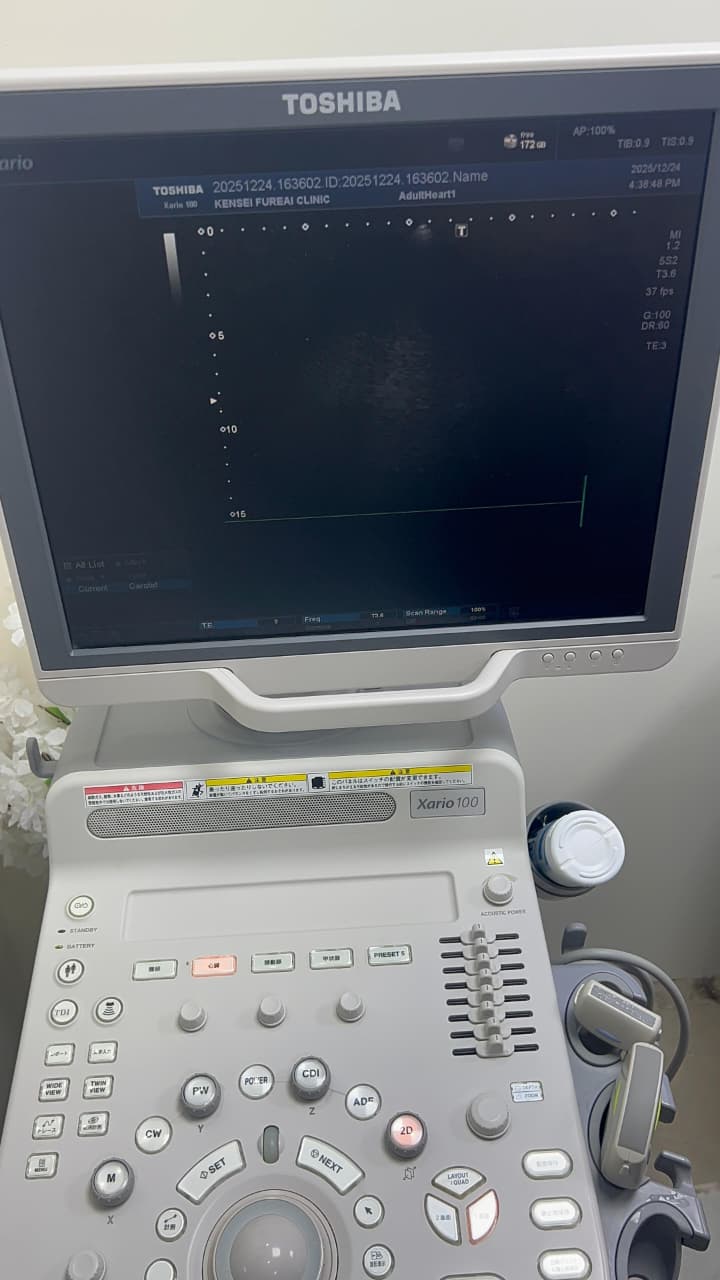 Toshiba Xario 100 ultrasound with cardiac,linear and convex probe refurbished equipment