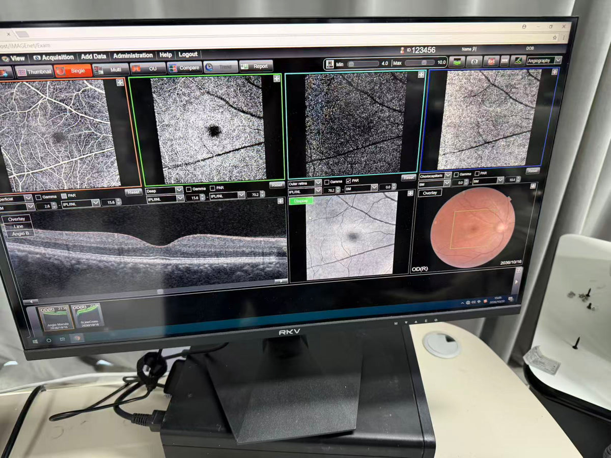 Topcon 3D OCT-1 Maestro 2 Optical Coherence Tomography (OCT) System – 2020