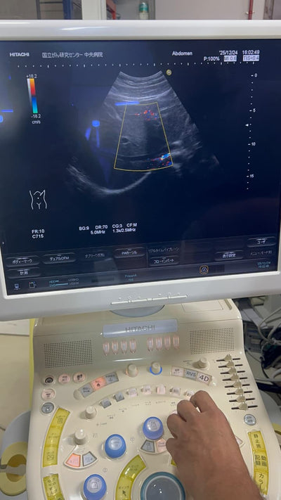 Hitachi Hi Vision preirus ultrasound convex and linear probe