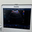 Philips CX50 portable ultrasound with convex and TVS probe