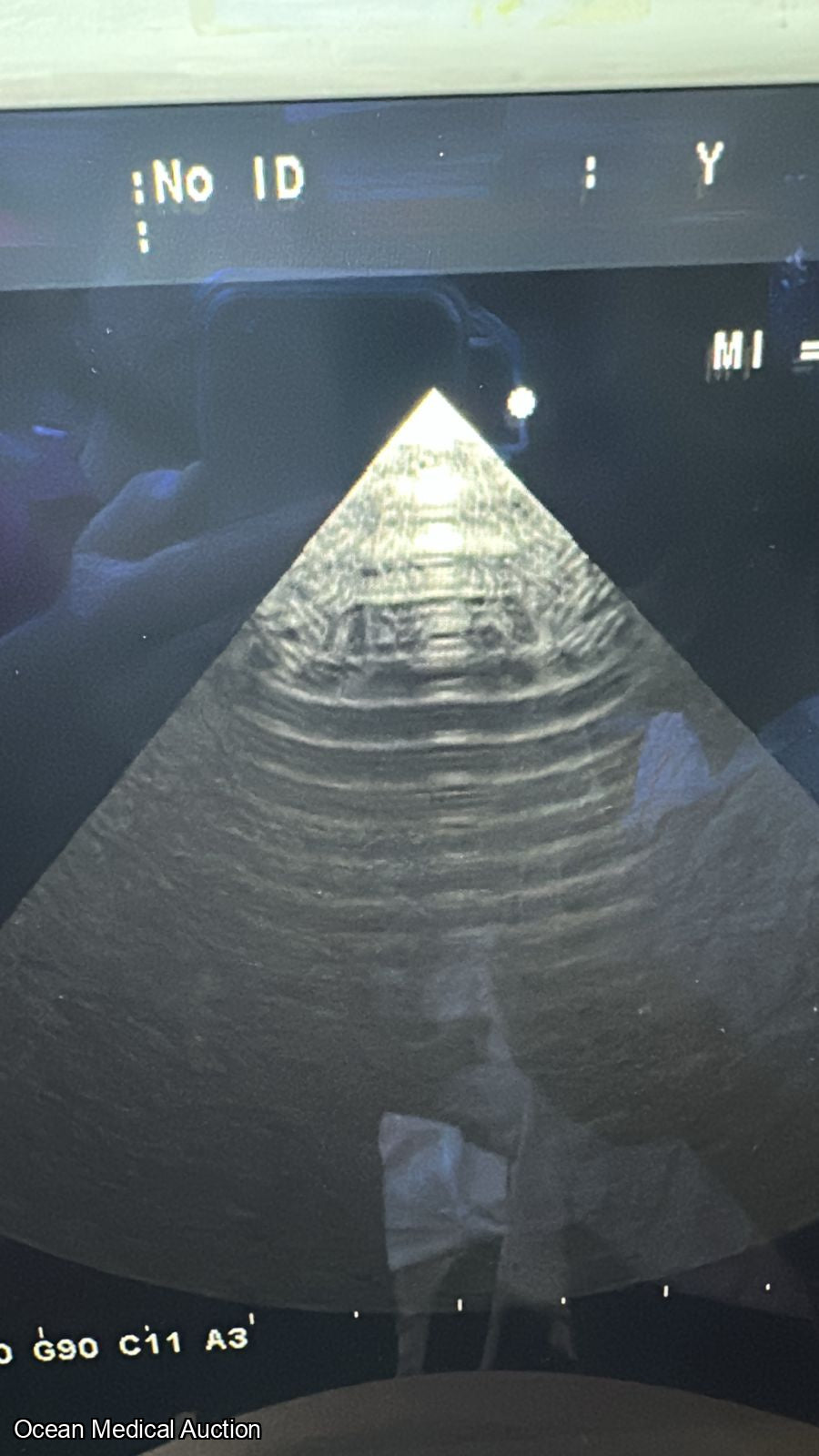 Aloka ust 52114P ntraoperative / phased-array ultrasound transducer (probe) SN.200D3785