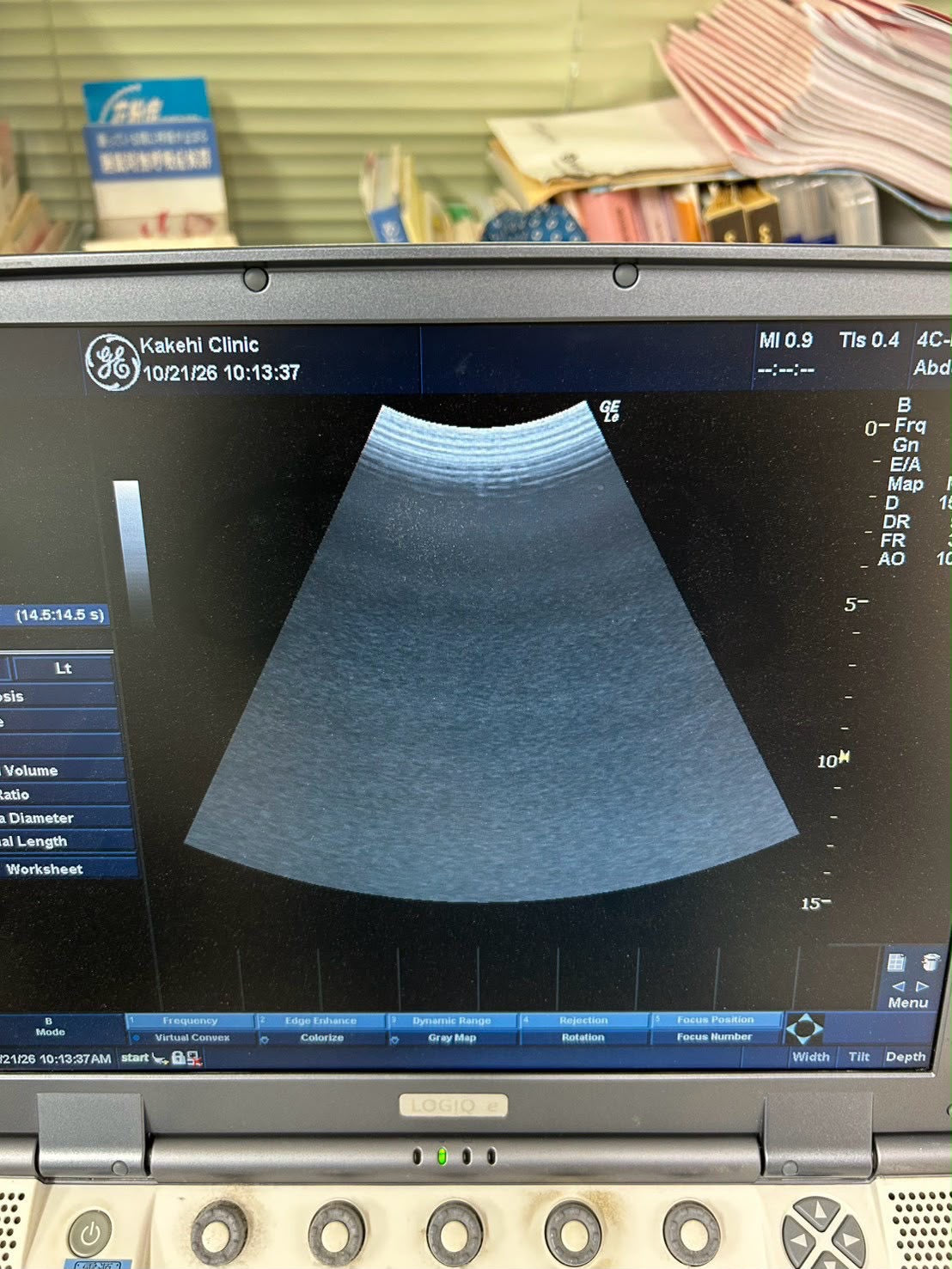 GE LOGIQ e Rev 2 Portable ultrasound