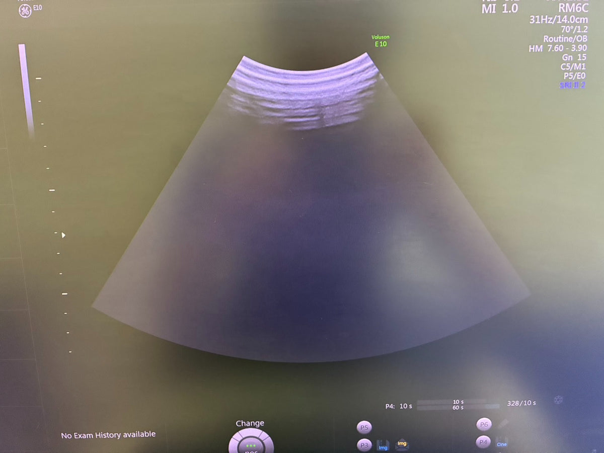 GE VOLUSON E10 Ultrasound