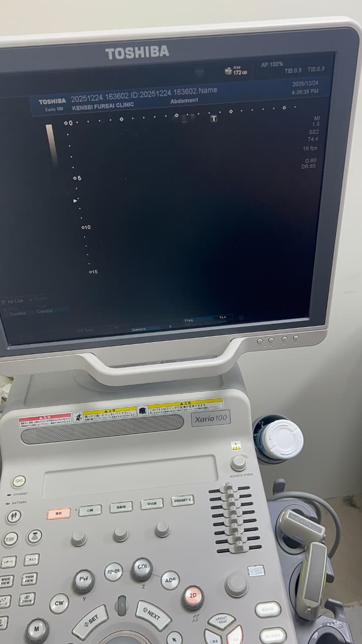 Toshiba Xario 100 ultrasound with cardiac,linear and convex probe refurbished equipment