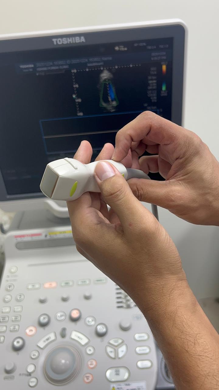 Toshiba Xario 100 ultrasound with cardiac,linear and convex probe refurbished equipment