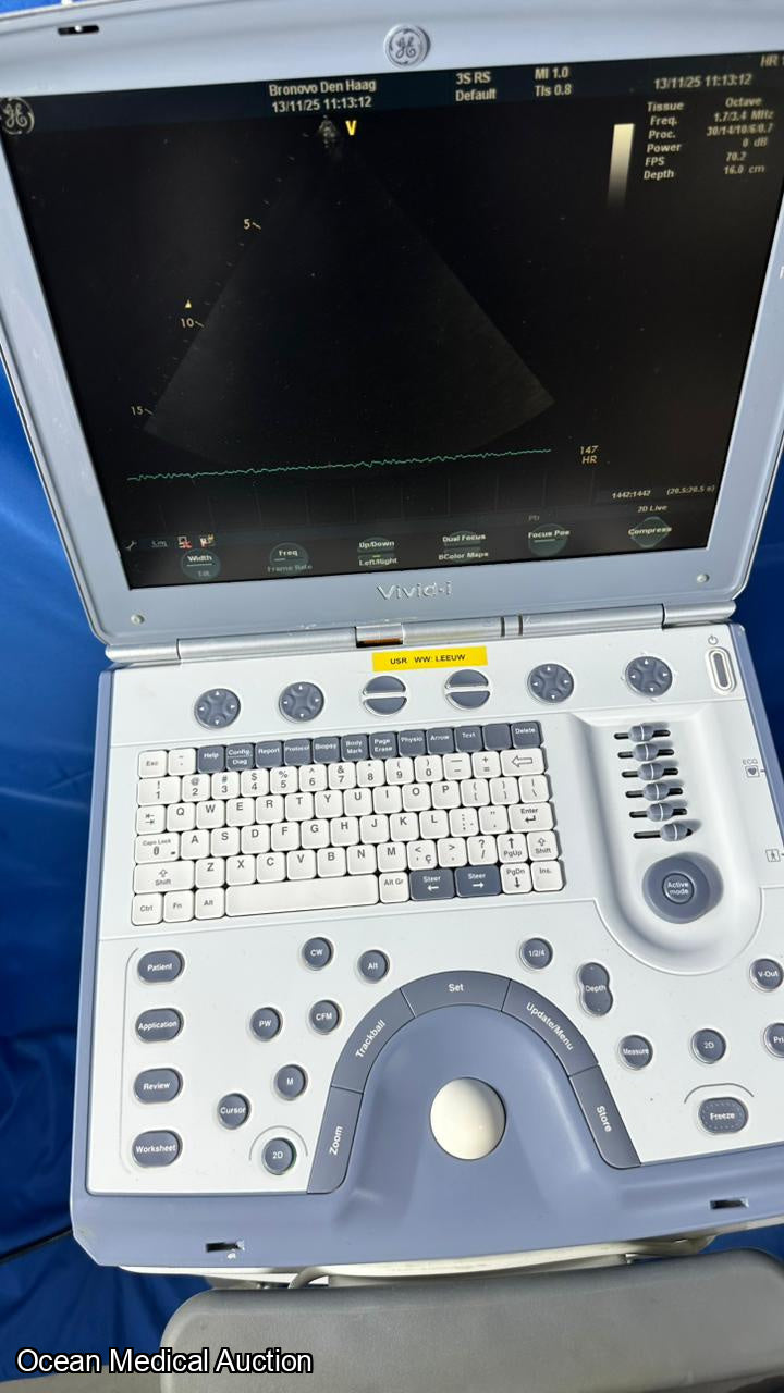 GE Vivid i Portable Ultrasound System (2007) with 3S-RS Cardiac Probe
