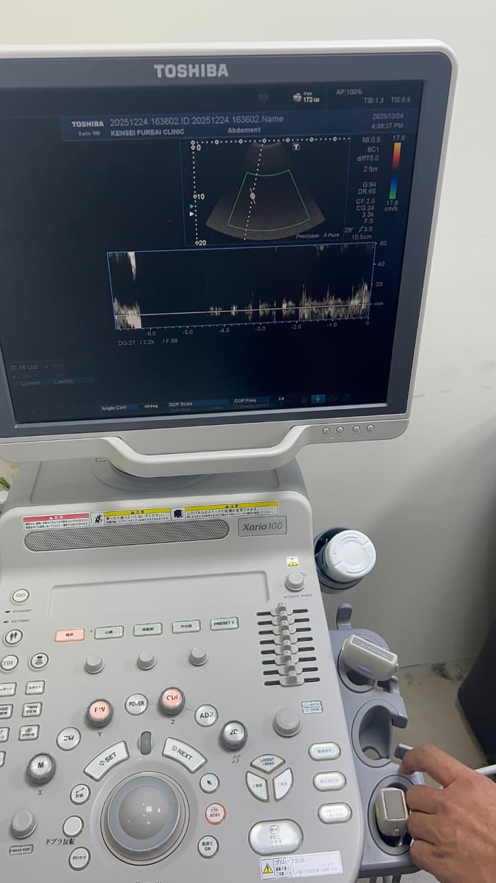 Toshiba Xario 100 ultrasound with cardiac,linear and convex probe refurbished equipment