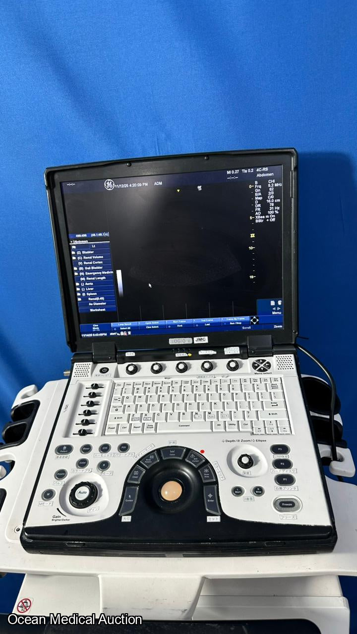 GE Logiq E Portable Ultrasound System (2012) with 3S-RS Cardiac Prob