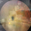 ZEISS CLARUS 500