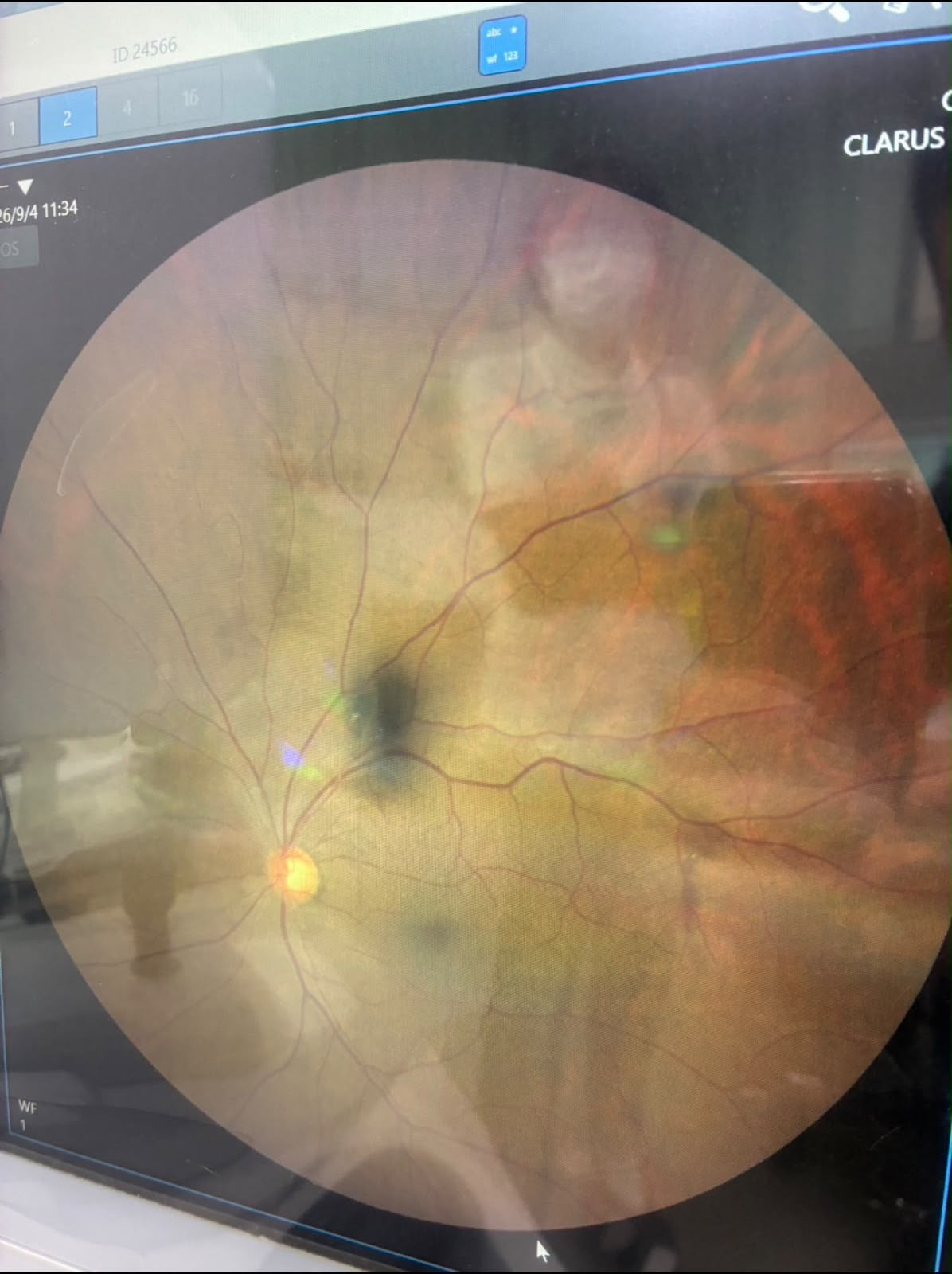 ZEISS CLARUS 500