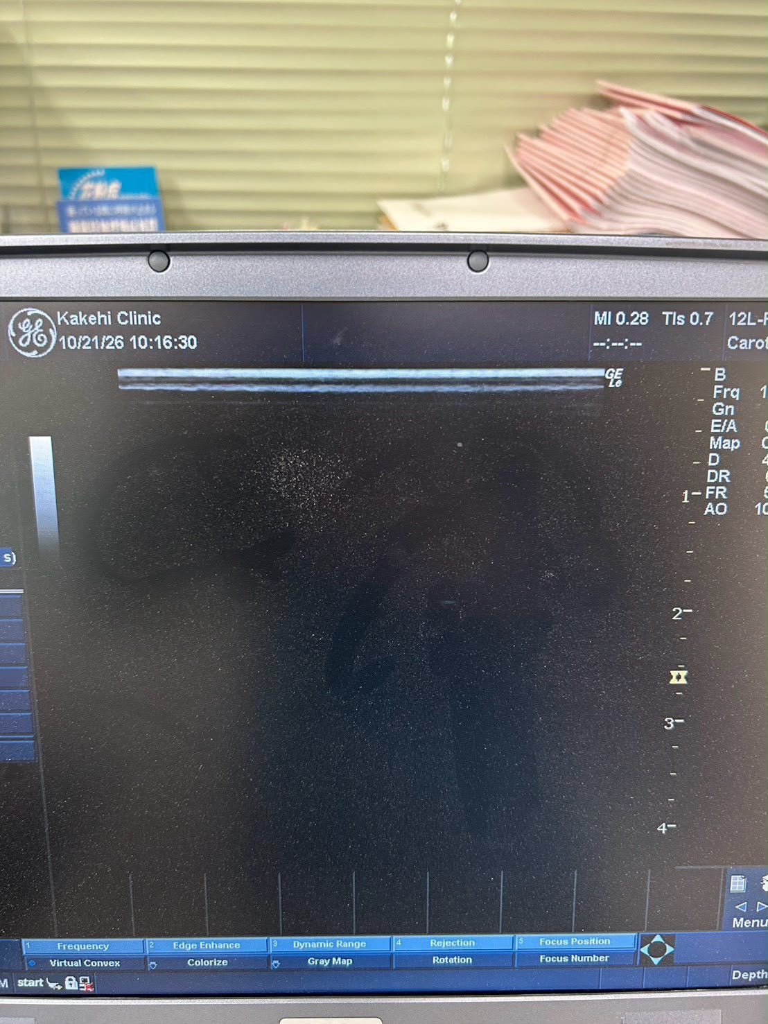 GE LOGIQ e Rev 2 Portable ultrasound