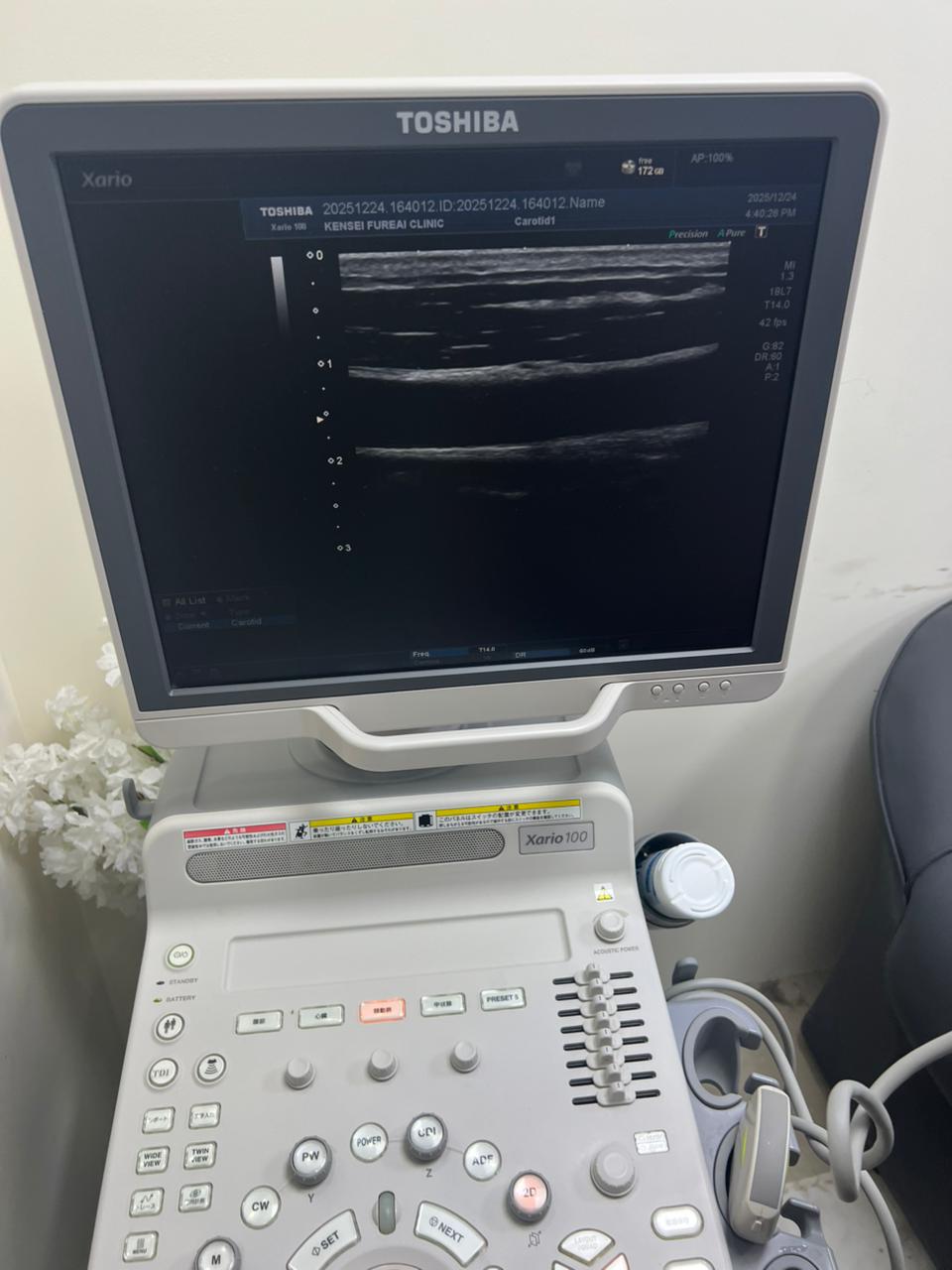 Toshiba Xario 100 ultrasound with cardiac,linear and convex probe refurbished equipment