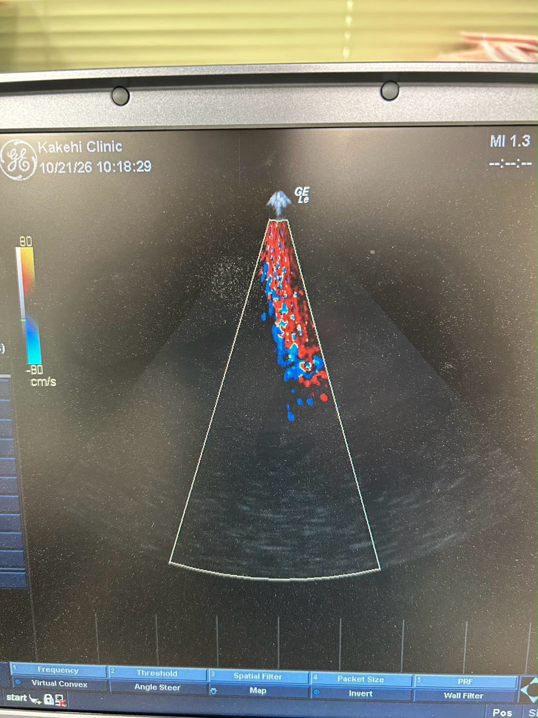GE LOGIQ e Rev 2 Portable ultrasound
