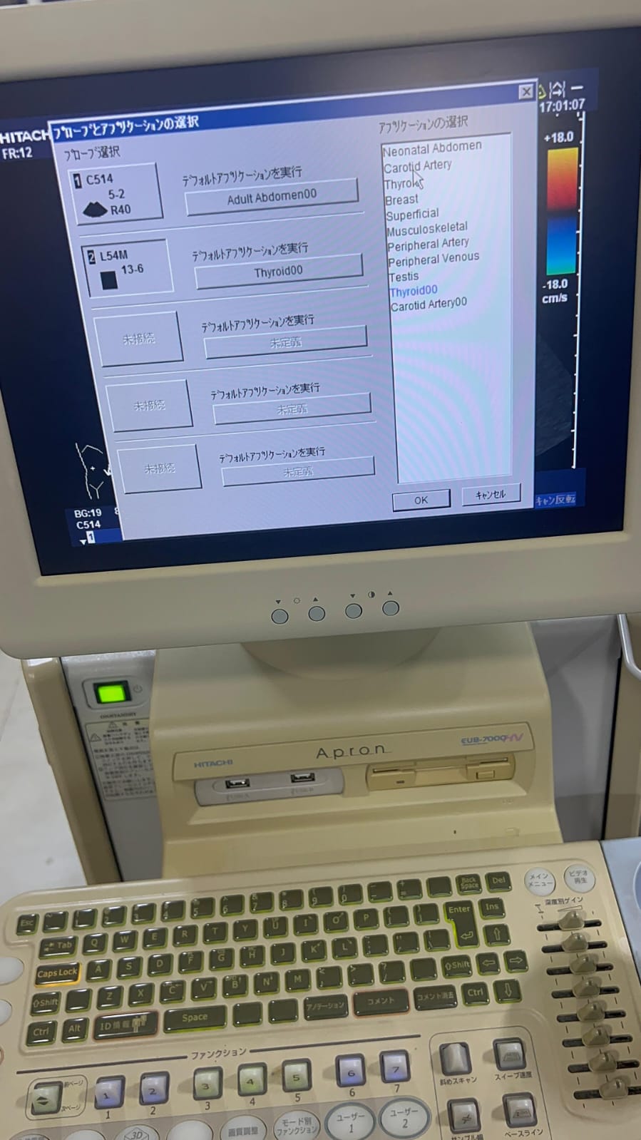 Hitachi apron ultrasound with convex and linear probe