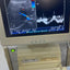 Hitachi apron ultrasound with convex and linear probe