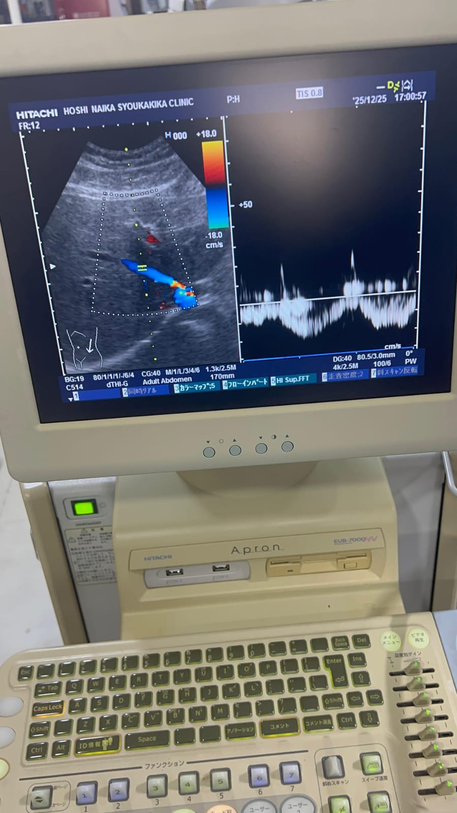 Hitachi apron ultrasound with convex and linear probe