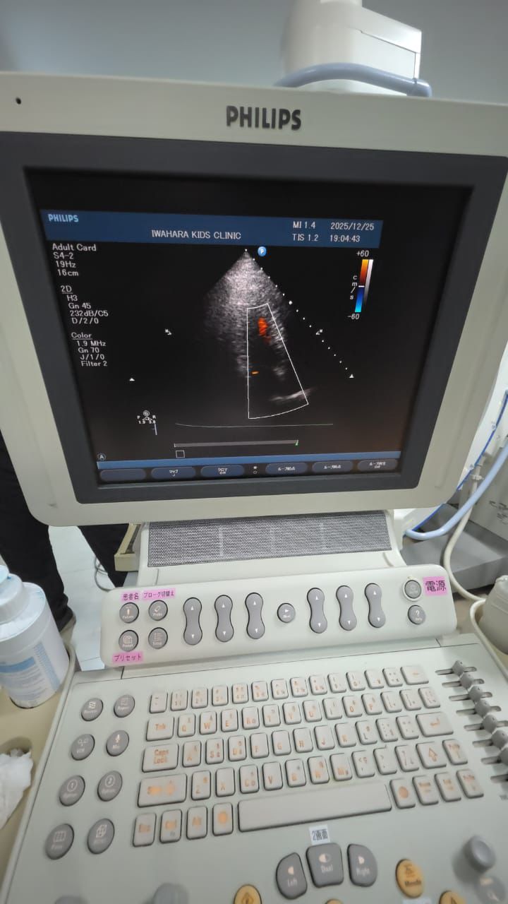 Hd11xe ultrasound With adult cardiac pediatric cardiac  and linear probes