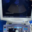 Hitachi Aloka alpha 7 ultrasound with convex,linear and cardiac probe