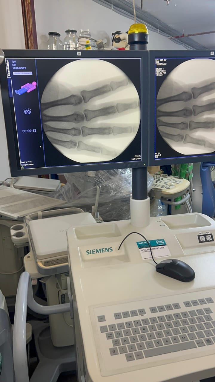 Siemens Arcadis Orbic 2015 C-ARM