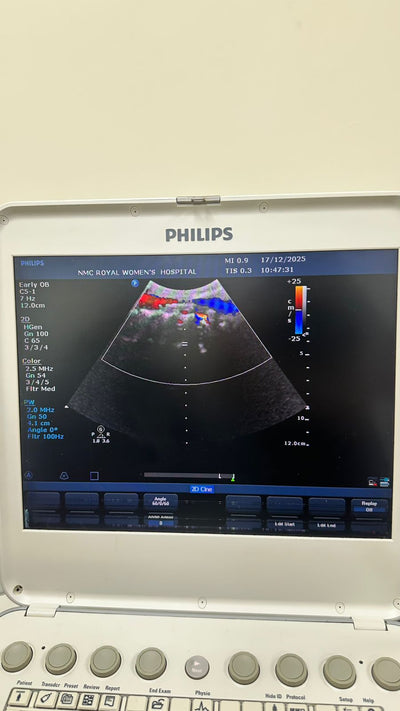 Philips CX50 portable ultrasound with convex and TVS probe