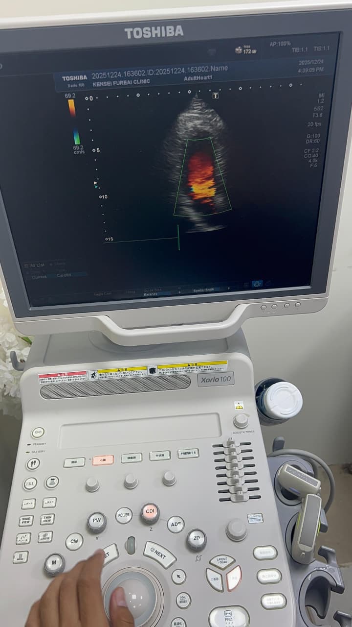 Toshiba Xario 100 ultrasound with cardiac,linear and convex probe refurbished equipment