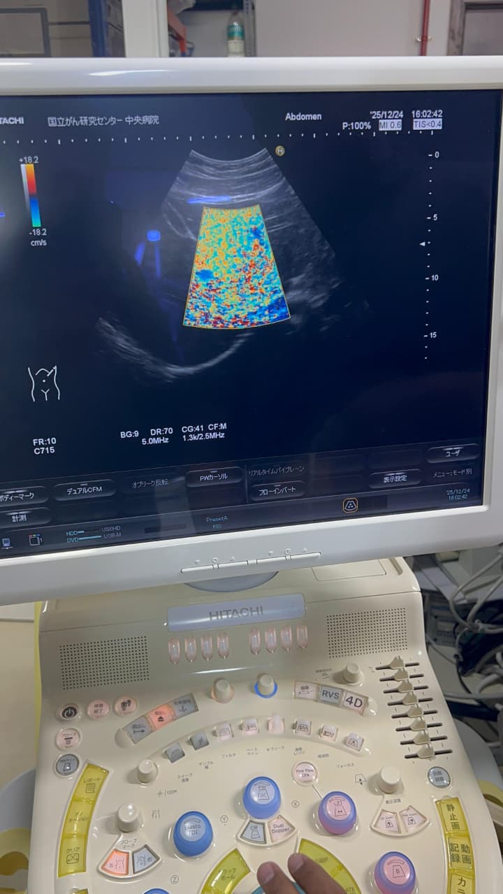 Hitachi Hi Vision preirus ultrasound convex and linear probe
