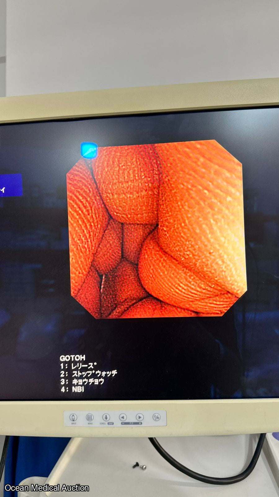 OLYMPUS PCF-240I SN.2030573