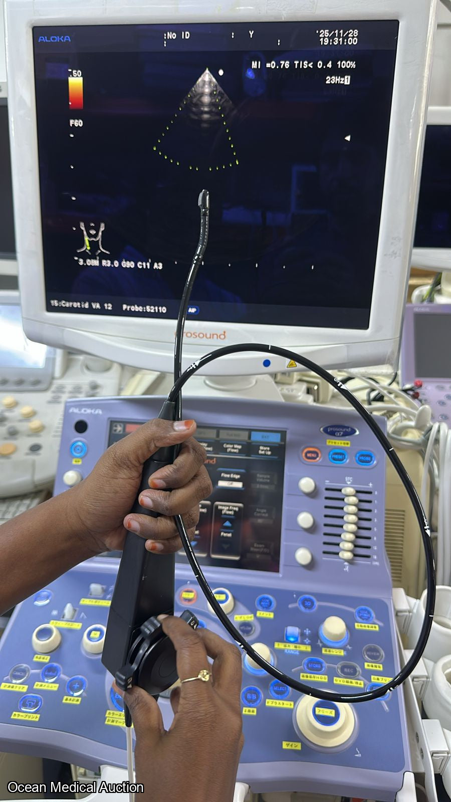 Aloka ust 52110s neonatal / pediatric T.E.E. SN.20004764