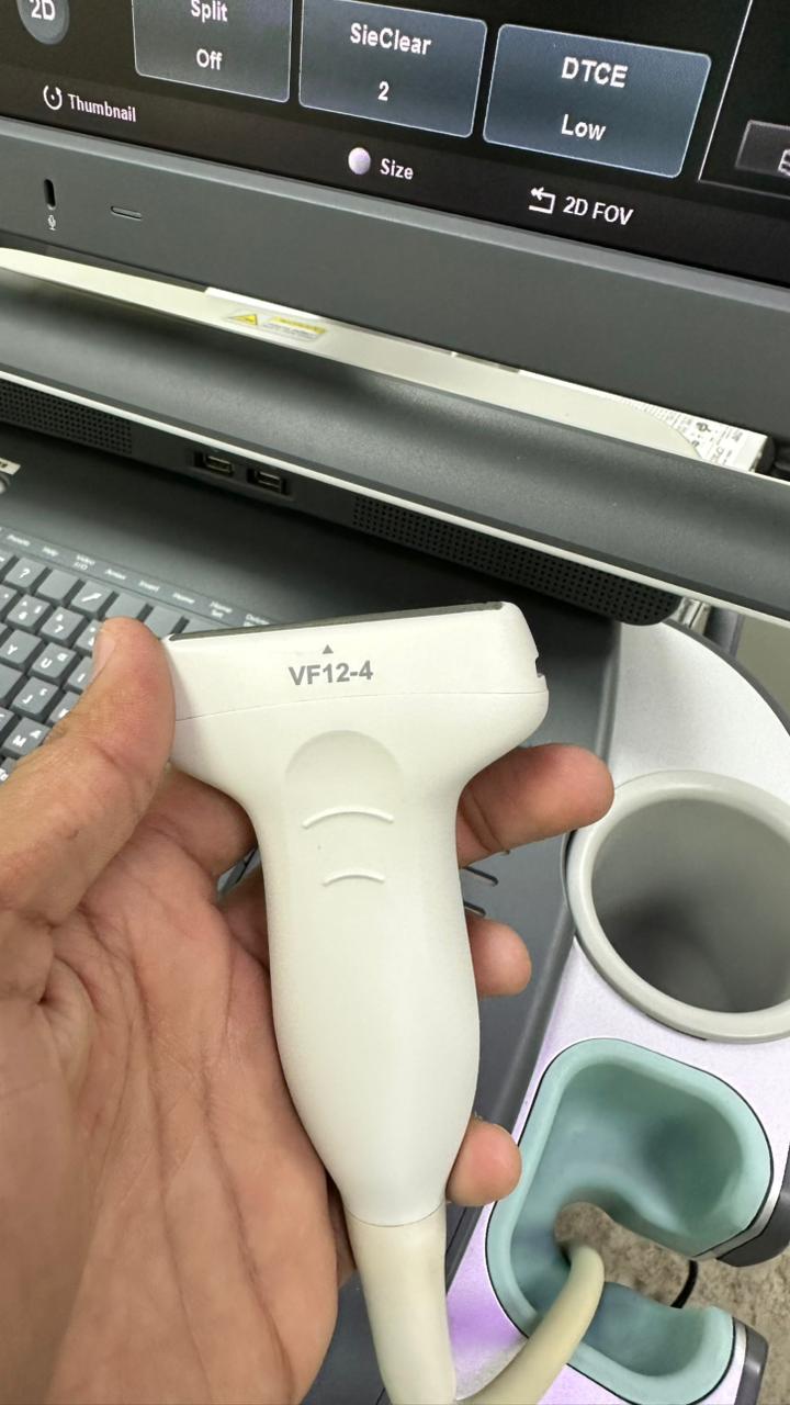SIEMENS ACUSON X700 ULTRASOUND WITH LINEAR AND CONVEX PROBE