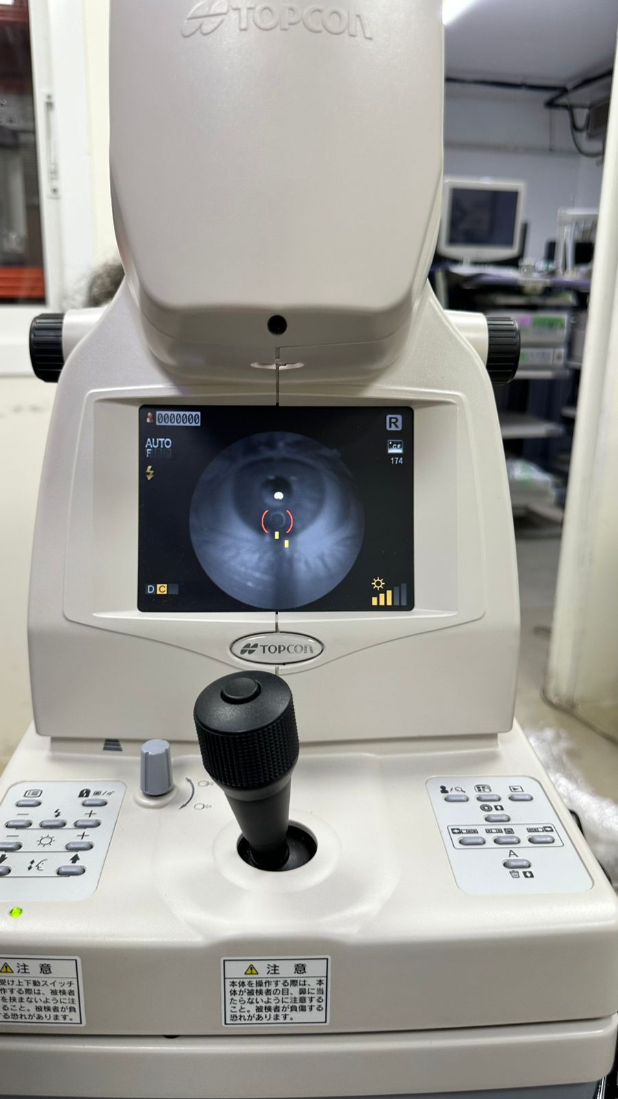 TRC NW300 Retinal camera